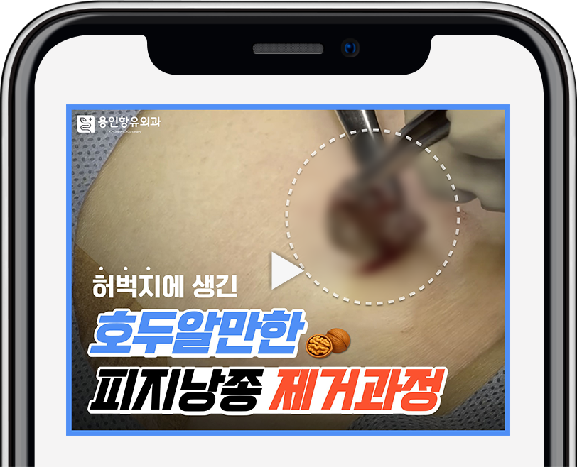 집도 영상 확인하기