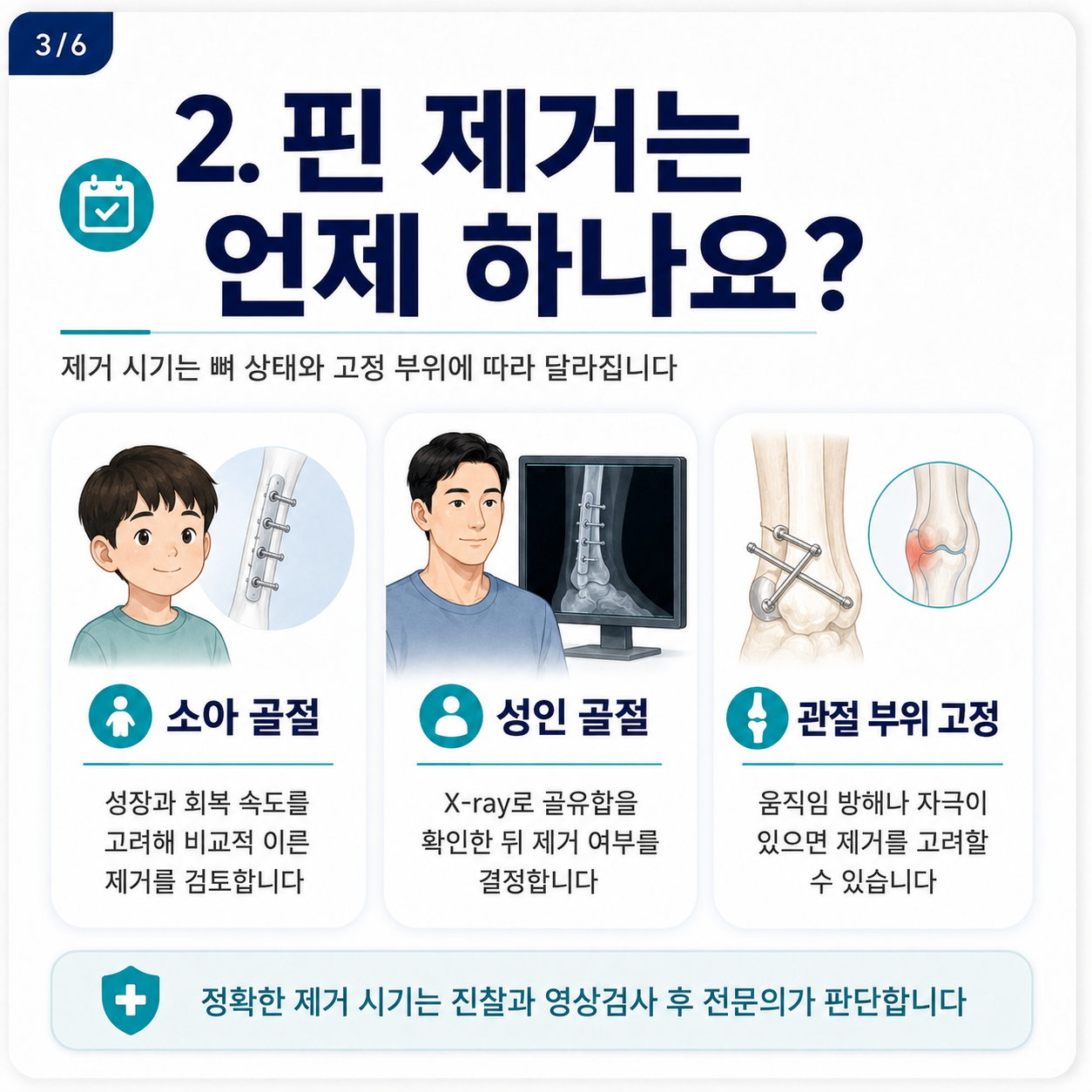 핀제거2.png