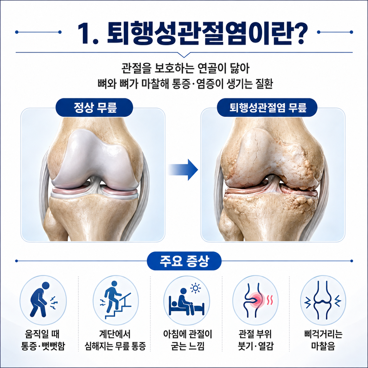 퇴행성1.png
