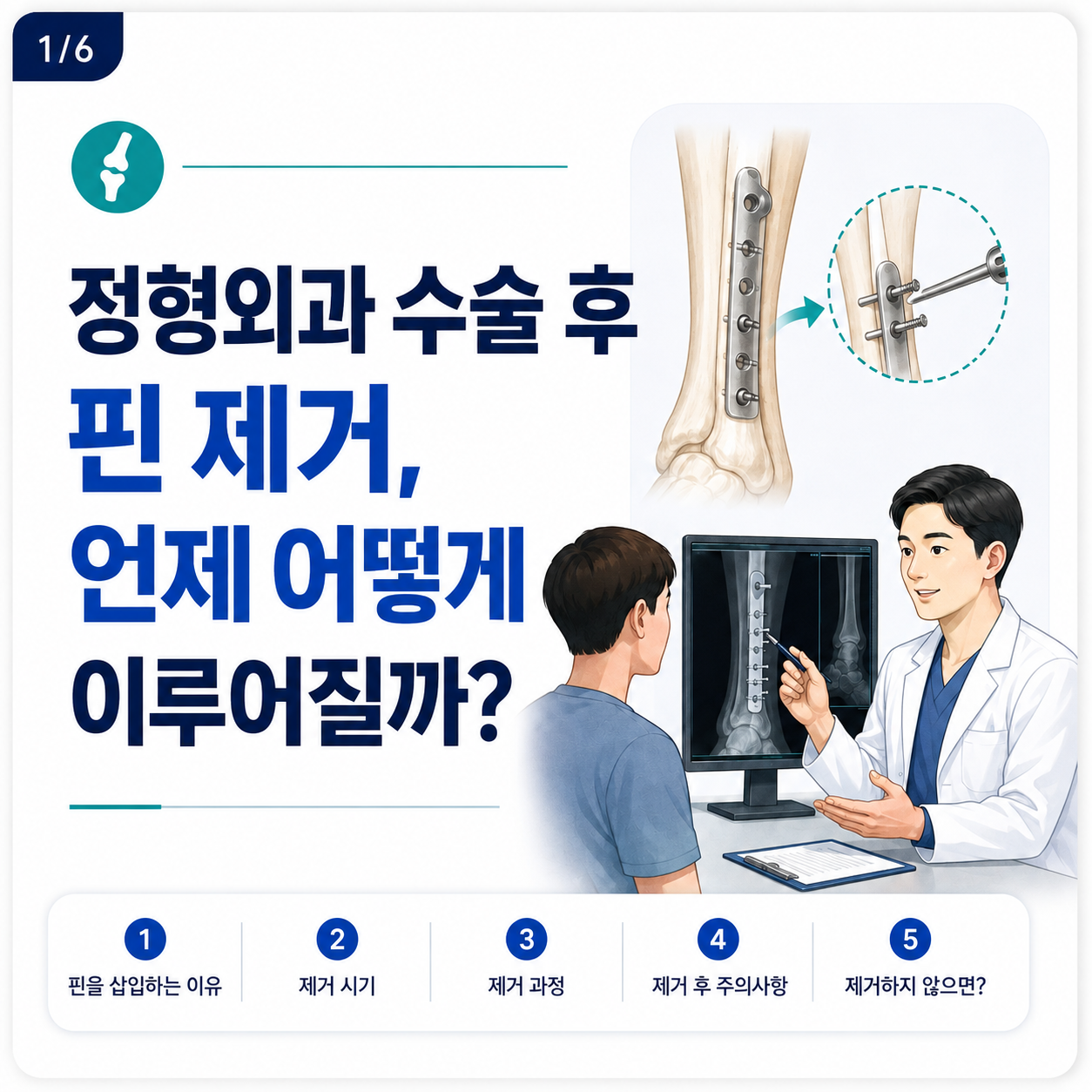 핀제거.png