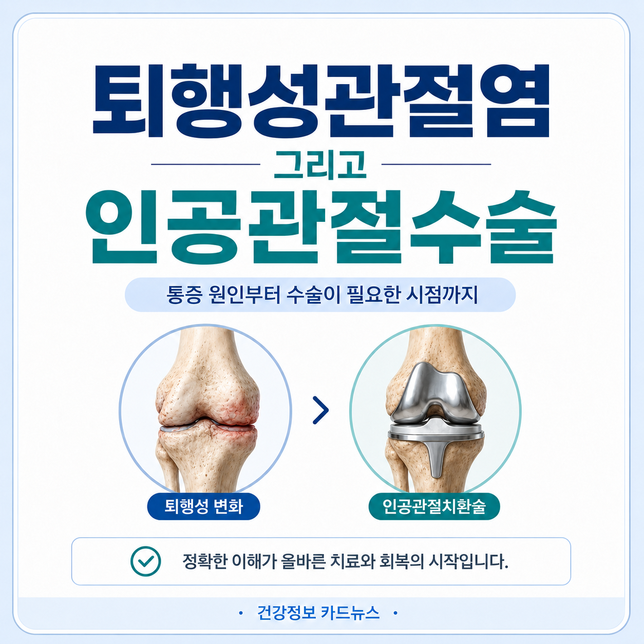퇴행성관절염.png