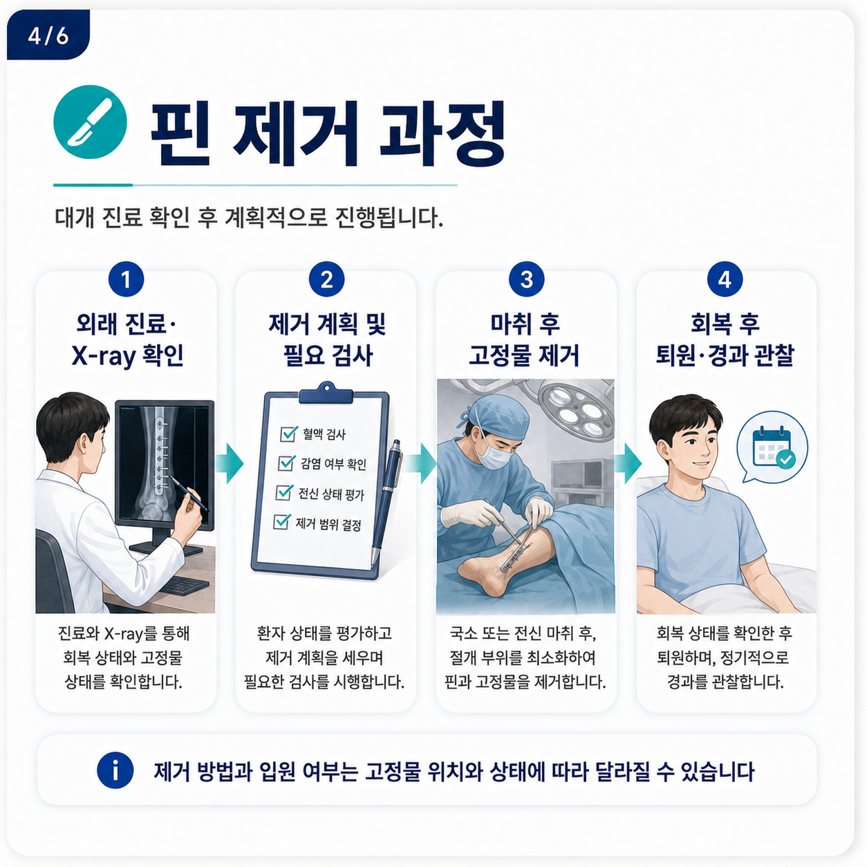 핀제거3.png
