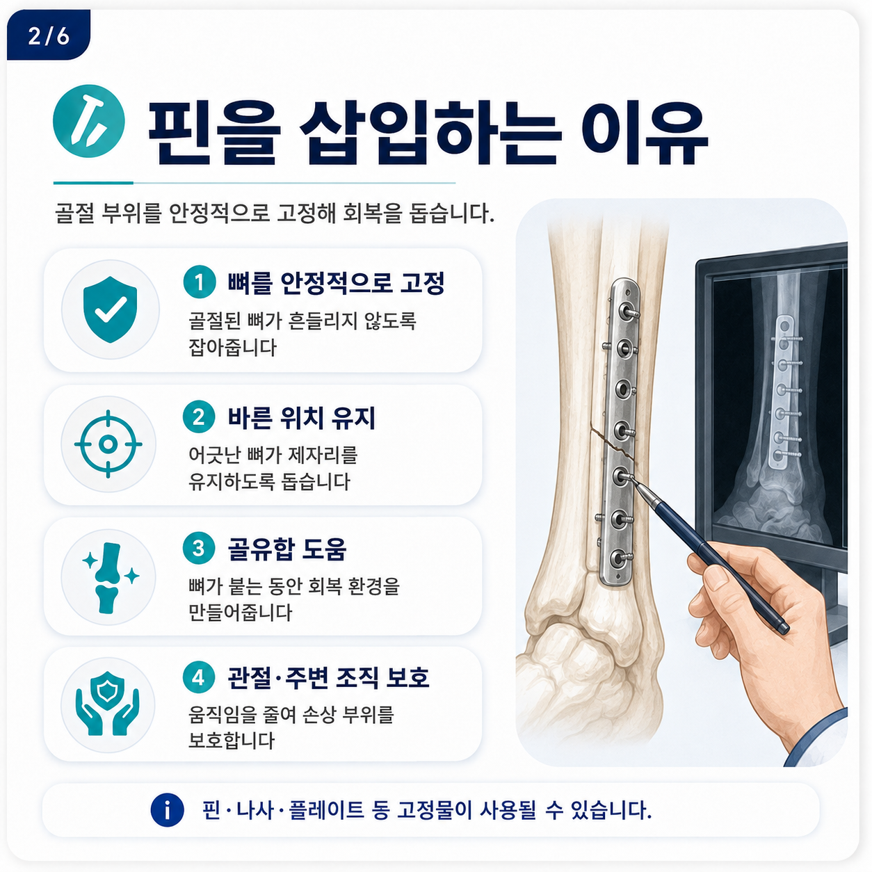 핀제거1.png