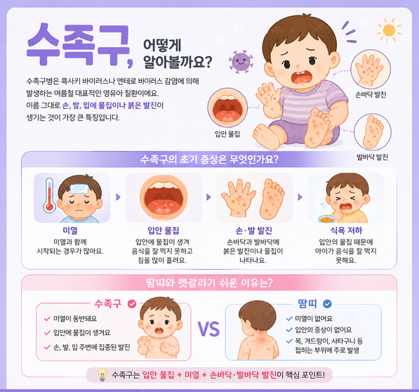 연신내 수족구와 땀띠 구별법_597x596.png