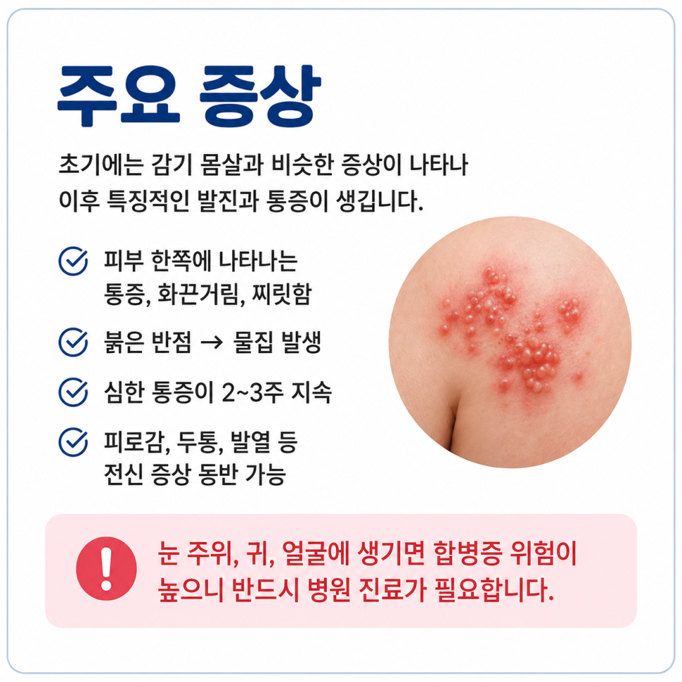 대상포진1.png
