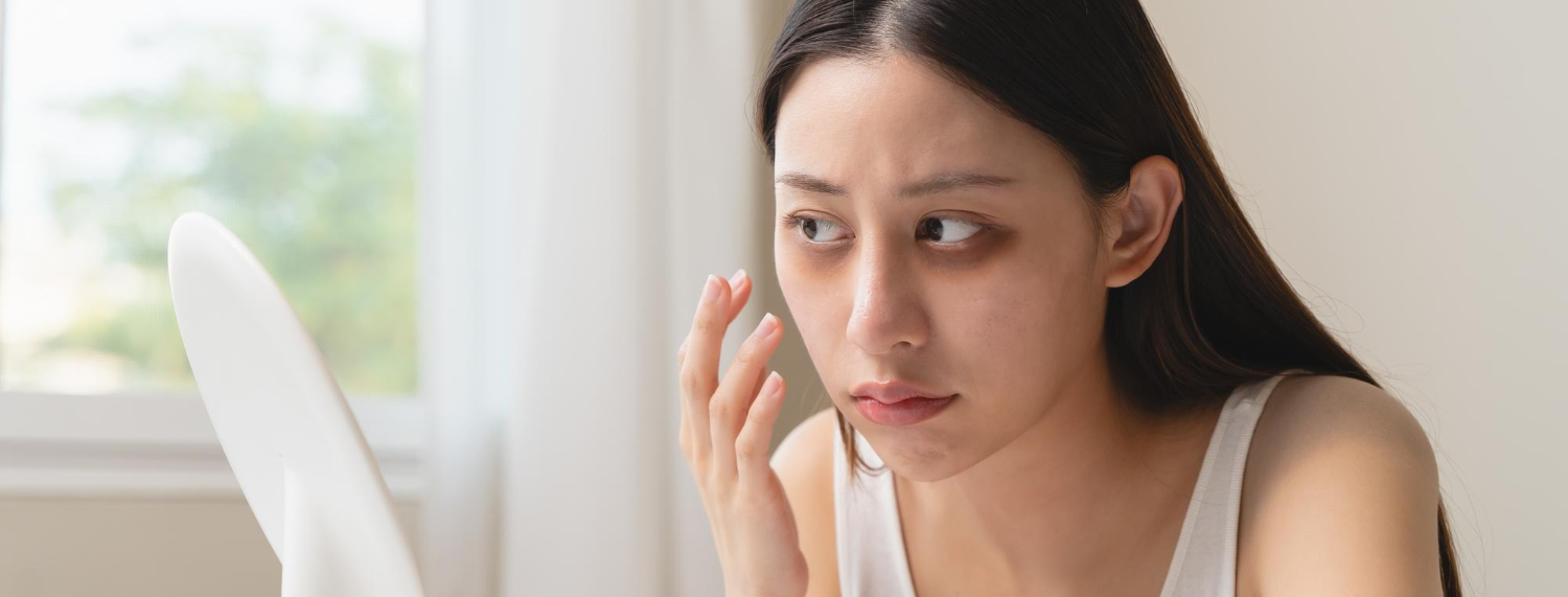 아토피 피부염 관련 이미지
