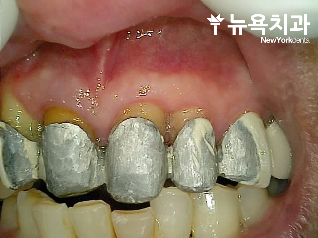 a315c41ee9d61.png