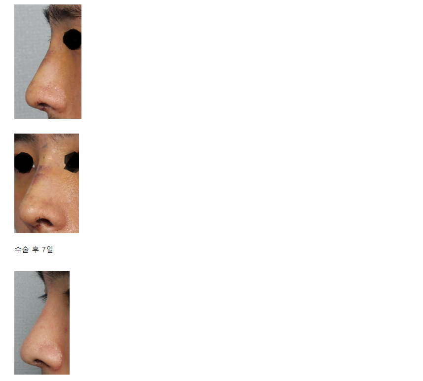 b28d65ef3132a.png